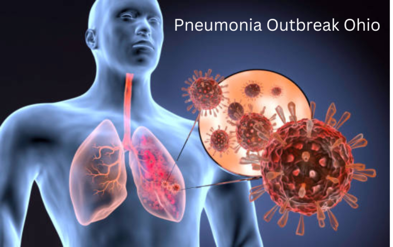 pneumonia outbreak ohio