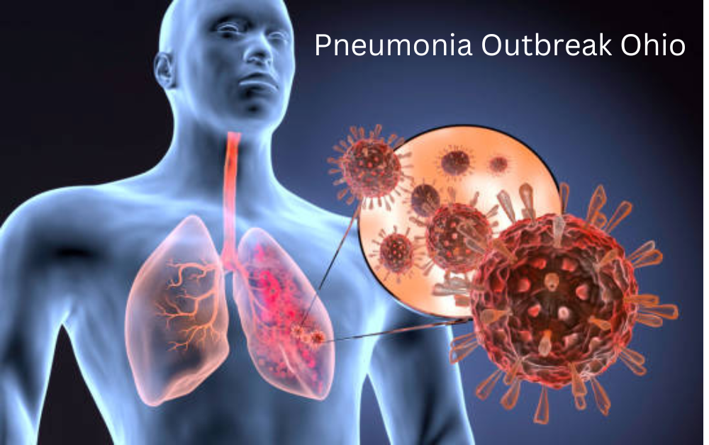 pneumonia outbreak ohio